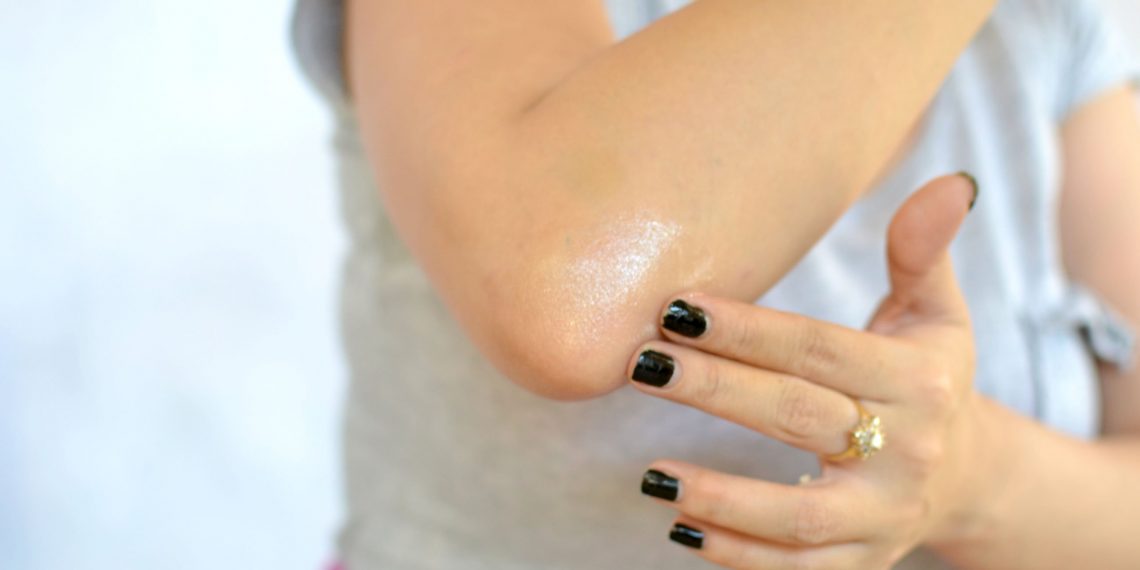 Smooth Skin on Elbows & Heels? I Know Easy Tricks!