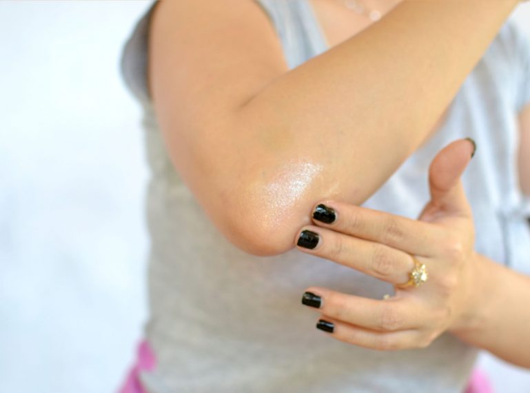 Smooth Skin on Elbows & Heels? I Know Easy Tricks!